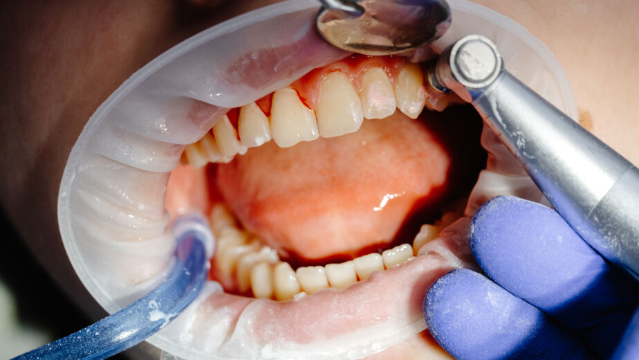 Fatih Periodontoloji