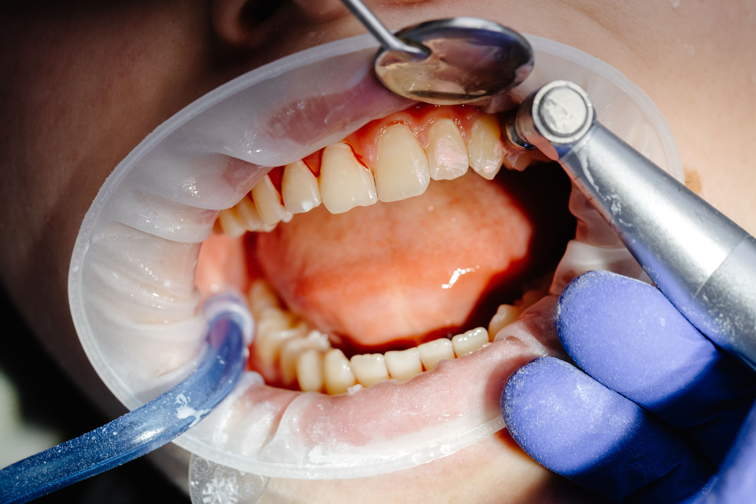 Fatih Periodontoloji